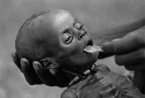 starving children in africa. StarvingKid-07.jpg image by